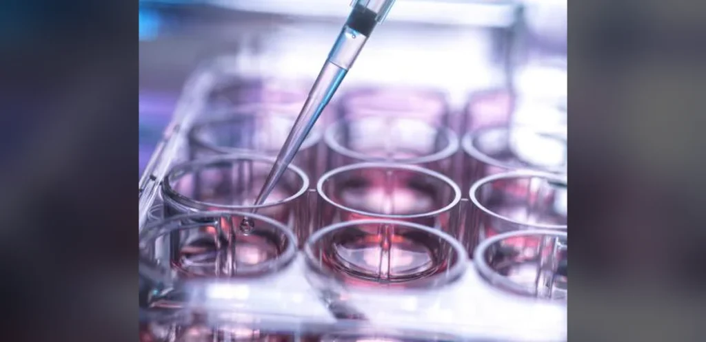 Parliamentary Report Warns of Risks in UK Stem Cell Transplant System