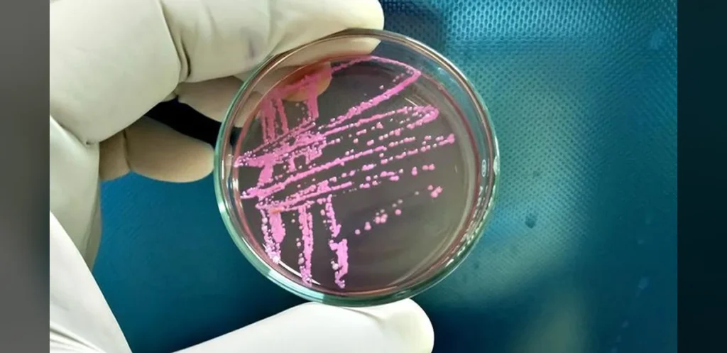 Kerala Confirms 85 Shigellosis Cases Through June With Preventive Steps Underway