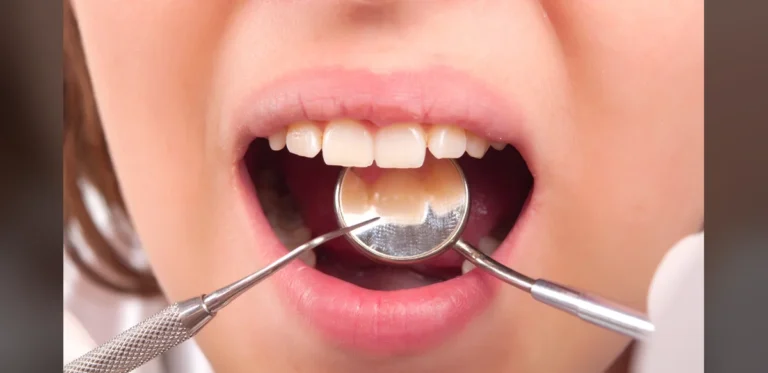 Netherlands Aging Population Strains Dental Services