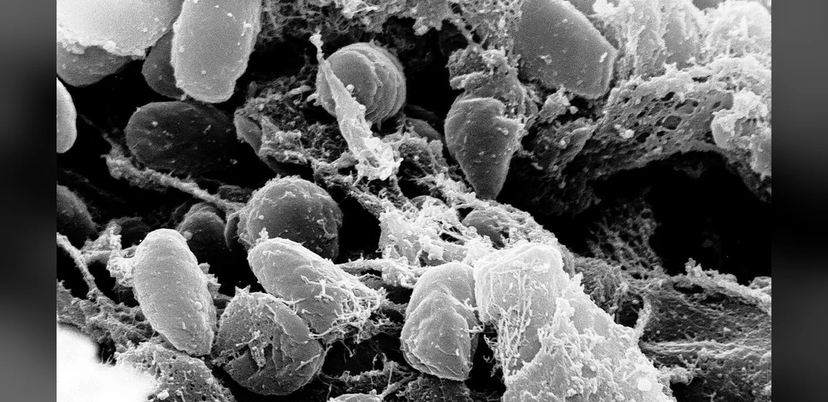 Diseases that changed history