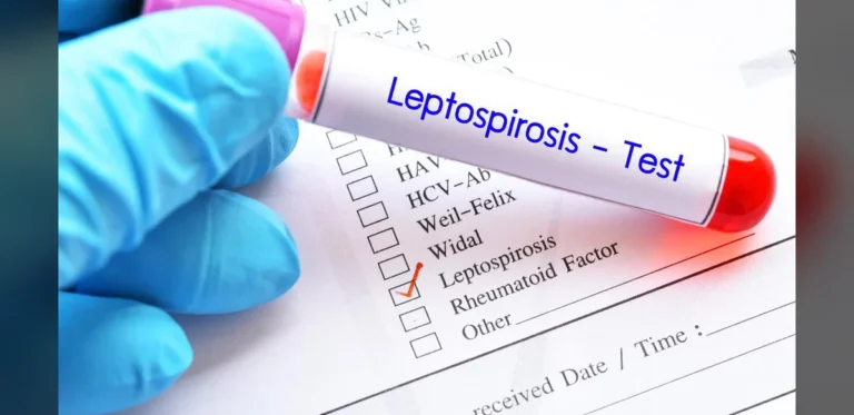 Why is Kerala facing high leptospirosis mortality? | Explained