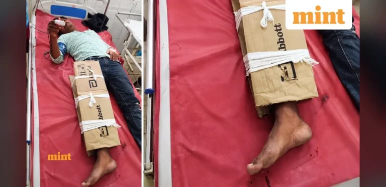 Viral Video Shows Cardboard Used as Support for Fractured Leg at Bihar Hospital