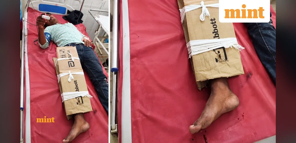 Viral Video Shows Cardboard Used as Support for Fractured Leg at Bihar Hospital