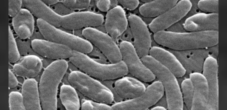 Health Officials Advise Precautions for Beach Visitors Amid Rise in Bacterial Infections on Gulf Coast