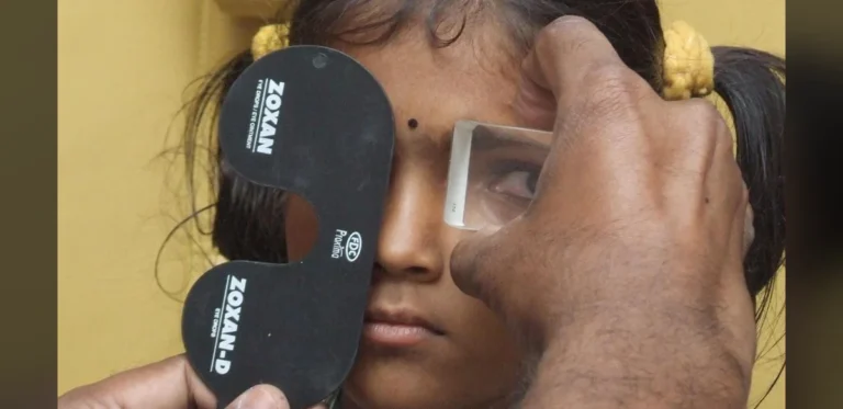 Understanding Squint Eye: Causes, Effects and Management Options