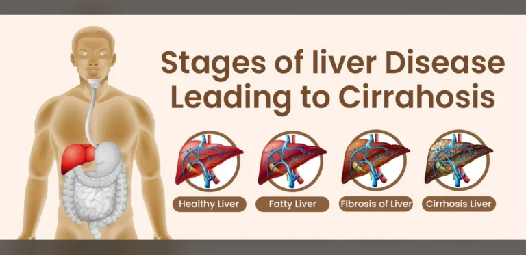Understanding Grade 1 Fatty Liver and Steps Toward Improvement