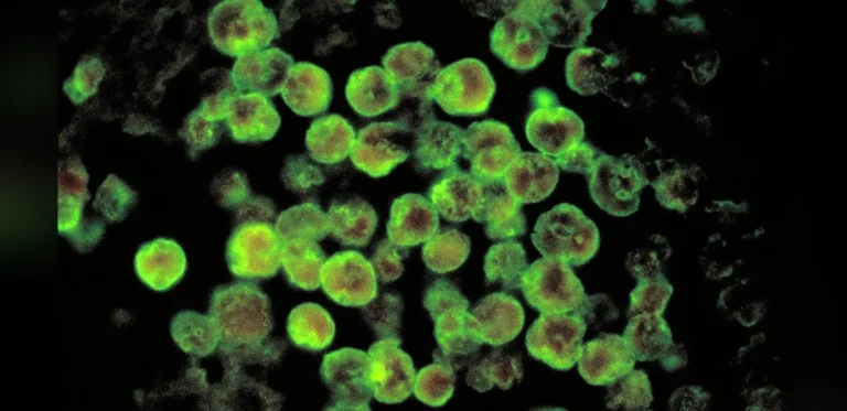 Research from ICMR Points to Well Water Quality as Key Concern in Kerala Brain Infection Cases