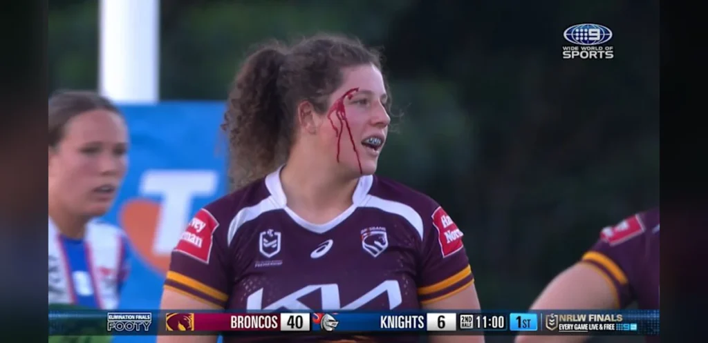 Brisbane Athletes Experience Head Collision During Play