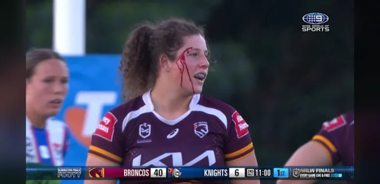 Brisbane Athletes Experience Head Collision During Play