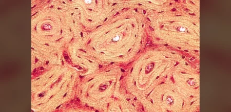 Bone Compression Technique Shows Potential to Reduce Traumatic Brain Injury Effects in Animal Models